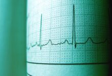 cbd and heart rate effects