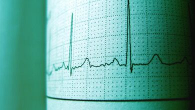 cbd and heart rate effects