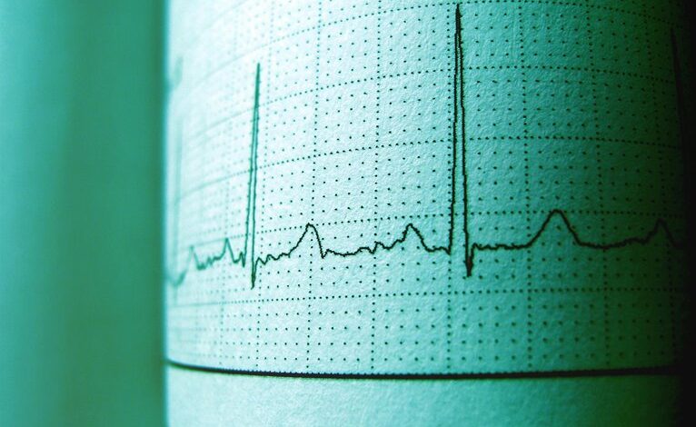 cbd and heart rate effects